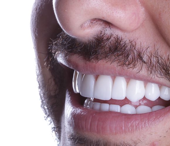 Reabilitação - Implantes e Lentes de Contato