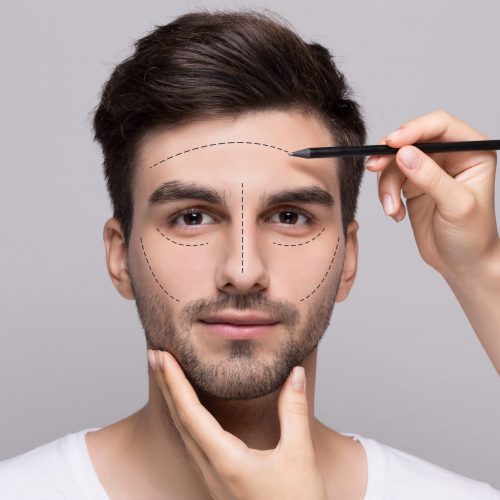 A Harmonização Orofacial trata a face tanto estética quanto funcionalmente.